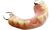 Broken Denture Repair