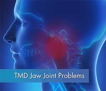 TMJ Jaw Joint Problems