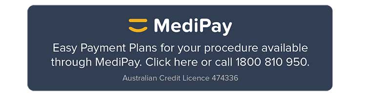 MediPay Payment Plan