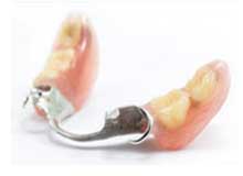 Metal Cast Partial Dentures