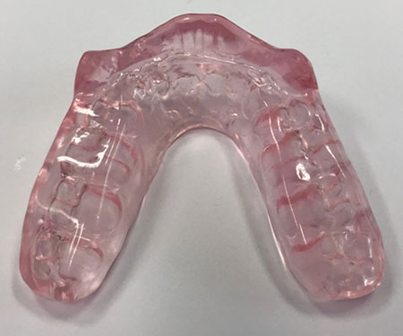 Fully Protected Occlusal Splints