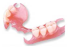 Flexible Partial Dentures